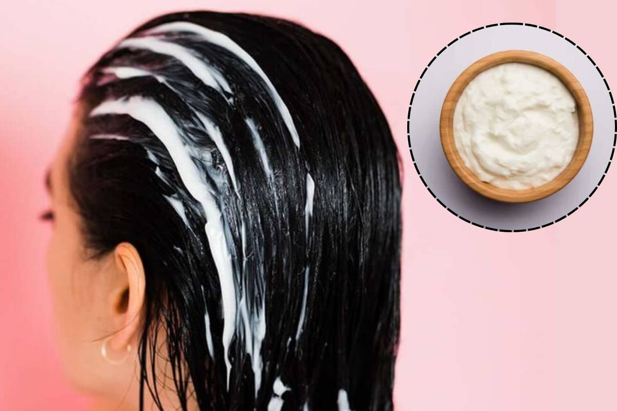 Home Remedies To Remove Dandruff Naturally